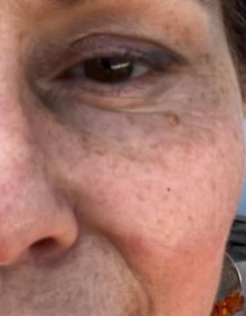 Close-up of a mature woman's face showing eye, crow's feet, freckles and natural skin texture
